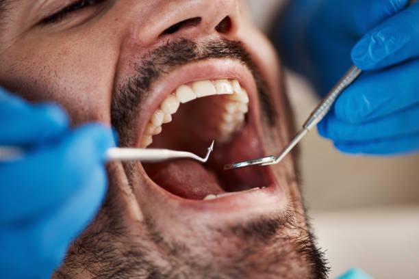 Best Knocked-Out Tooth Emergency  in Walcott, IA